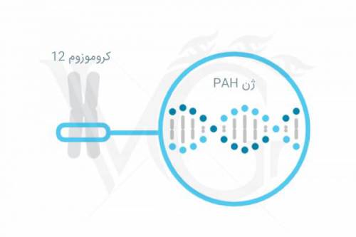 اختلال فینل کتونوریا (pku)